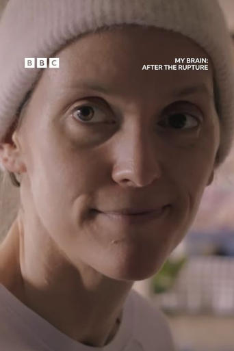 My Brain: After the Rupture Poster of My Brain: After the Rupture