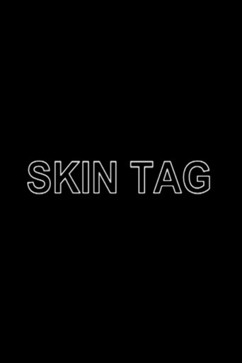 Skin Tag Poster of Skin Tag