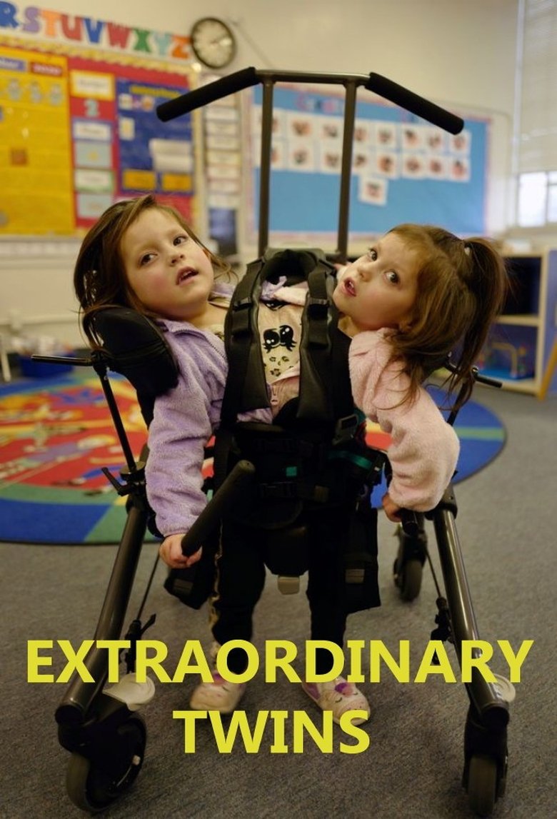 Extraordinary Twins Poster of Extraordinary Twins