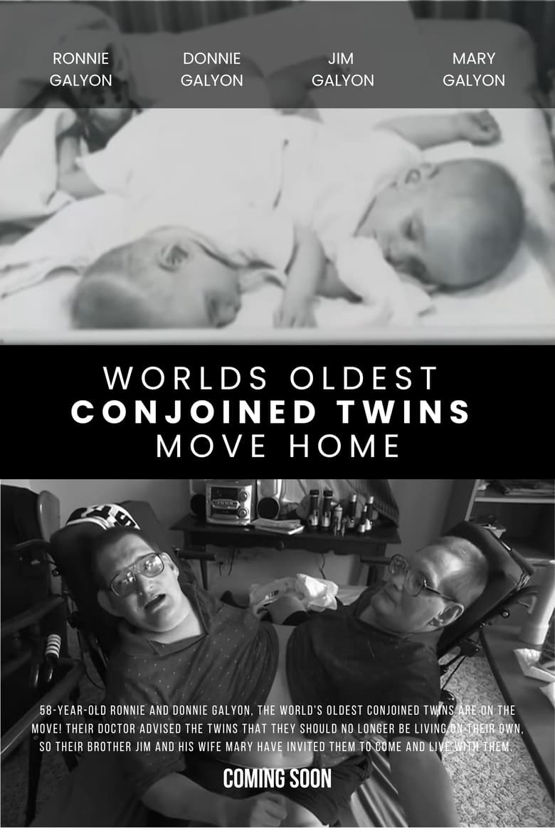 Poster of World's Oldest Conjoined Twins Move Home