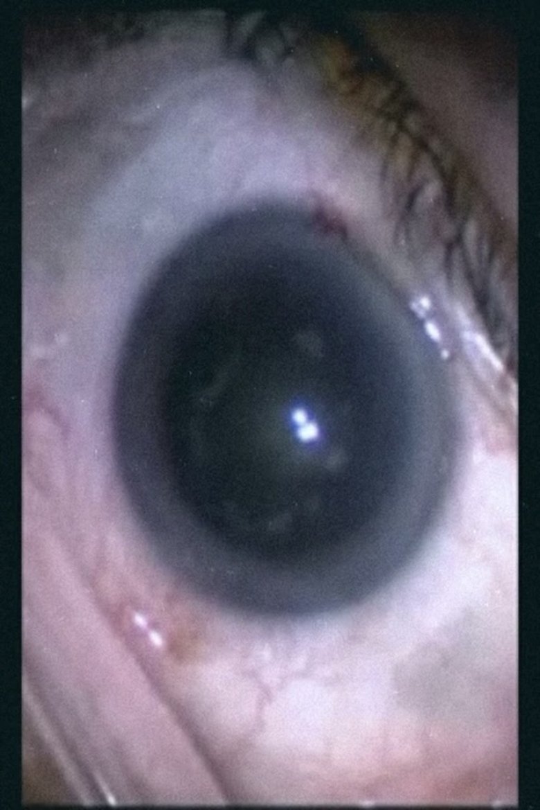 Poster of Botched Eyeball Operation