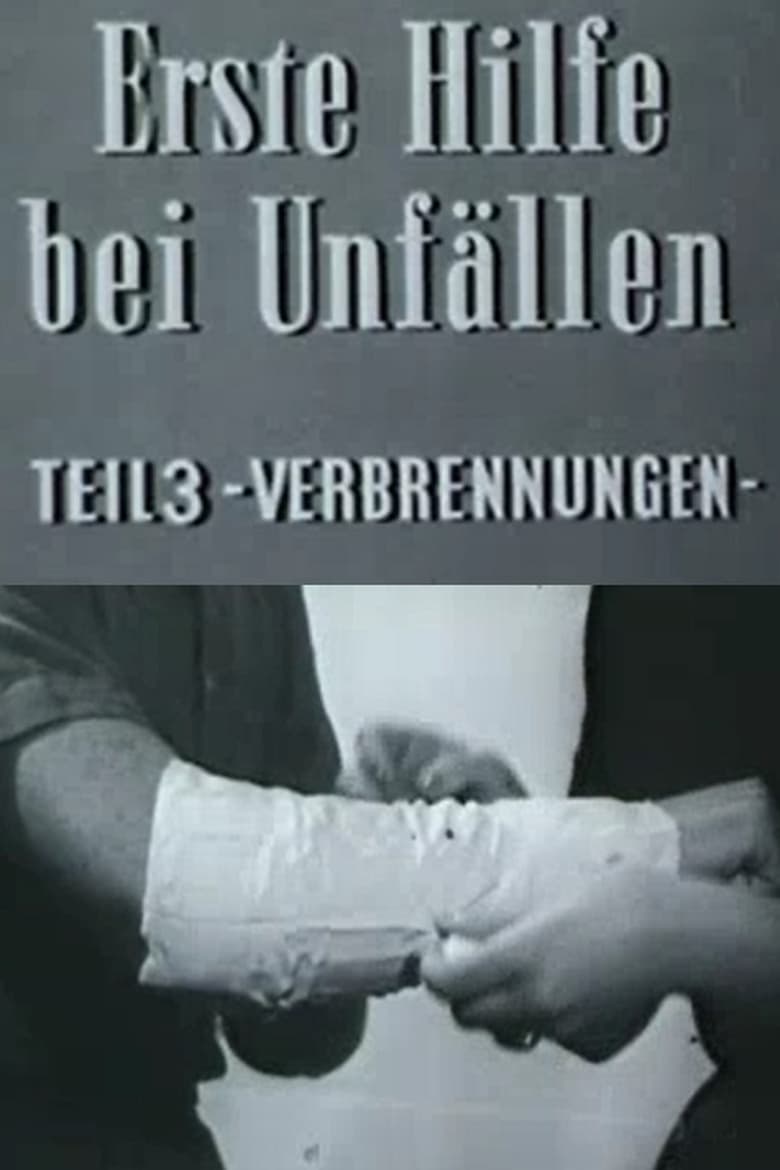 Poster of Erste Hilfe bei Unfällen: Verbrennungen