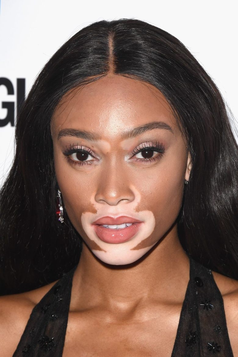 Portrait of Winnie Harlow