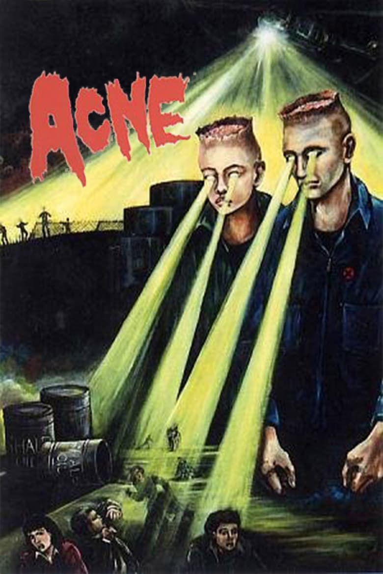 Poster of Acne