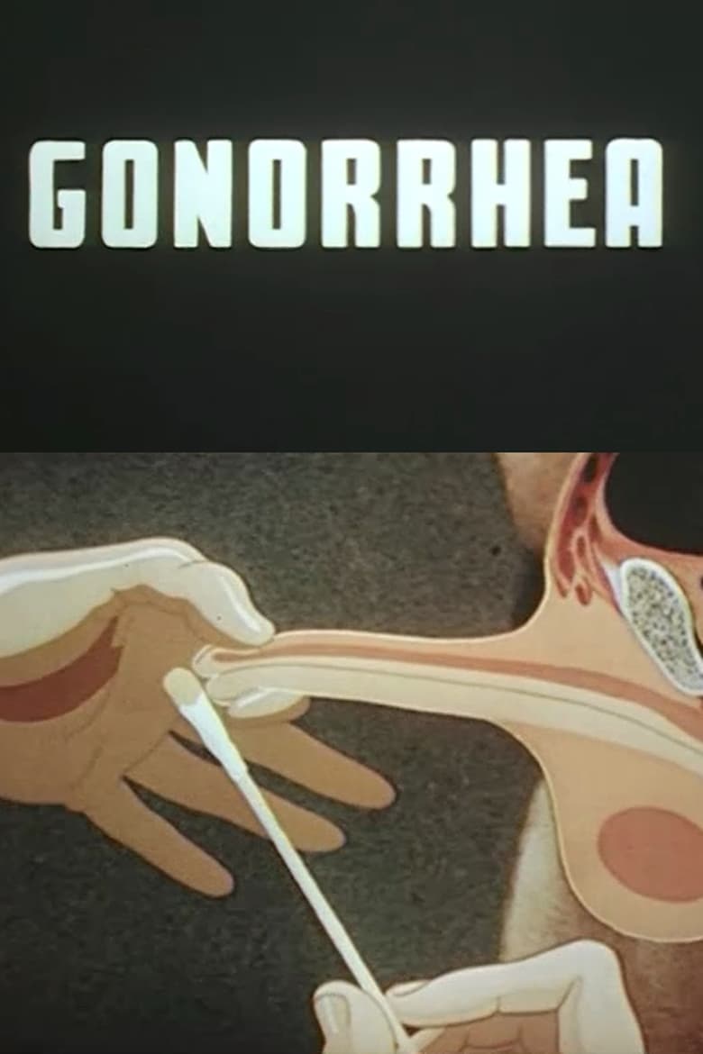 Poster of Gonorrhea