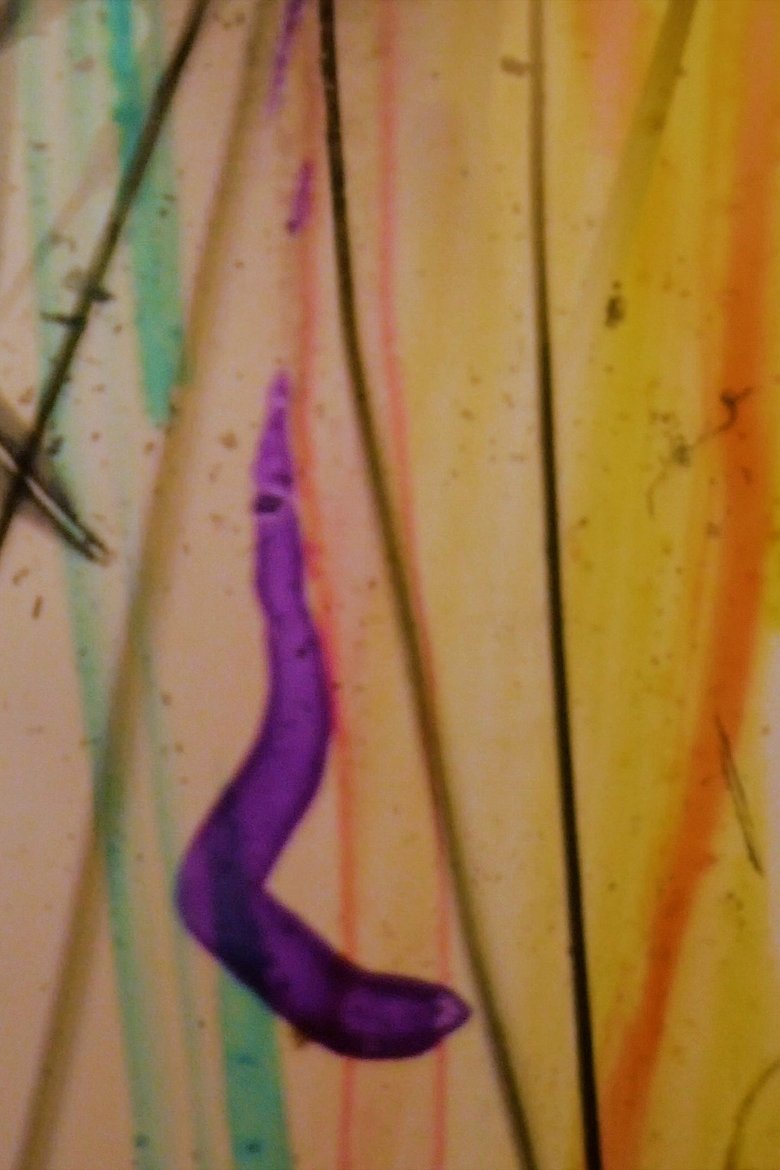 Poster of Visions From My Scalp