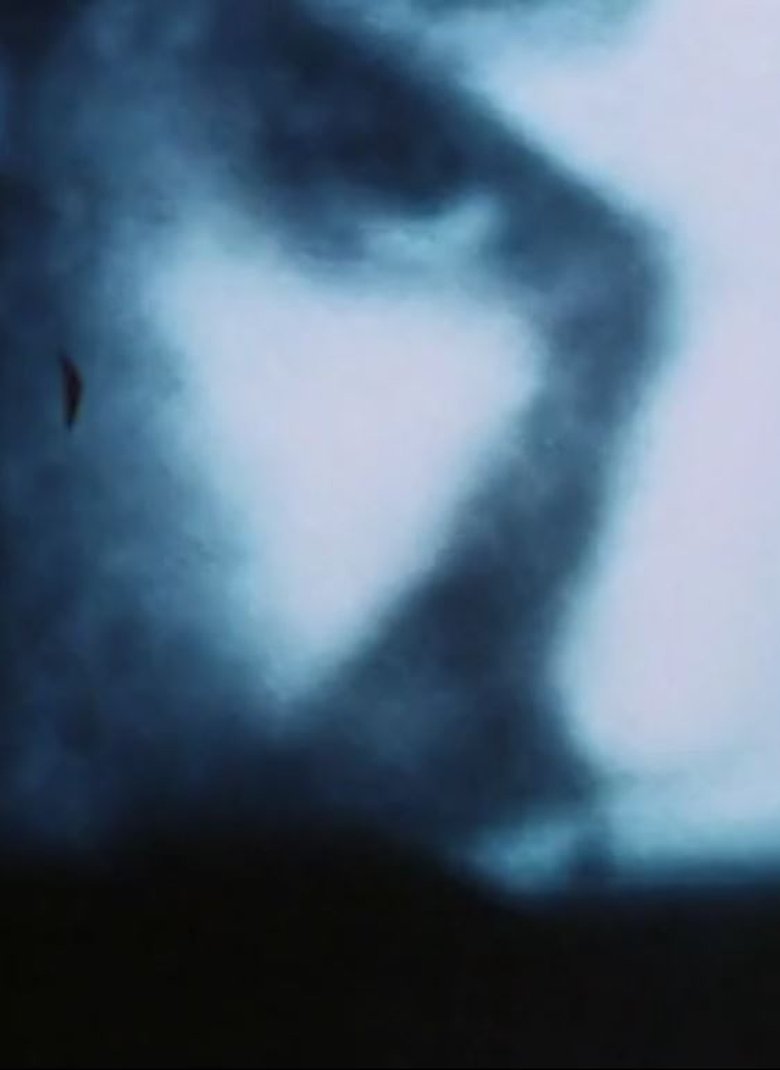 Poster of Endless Obsession
