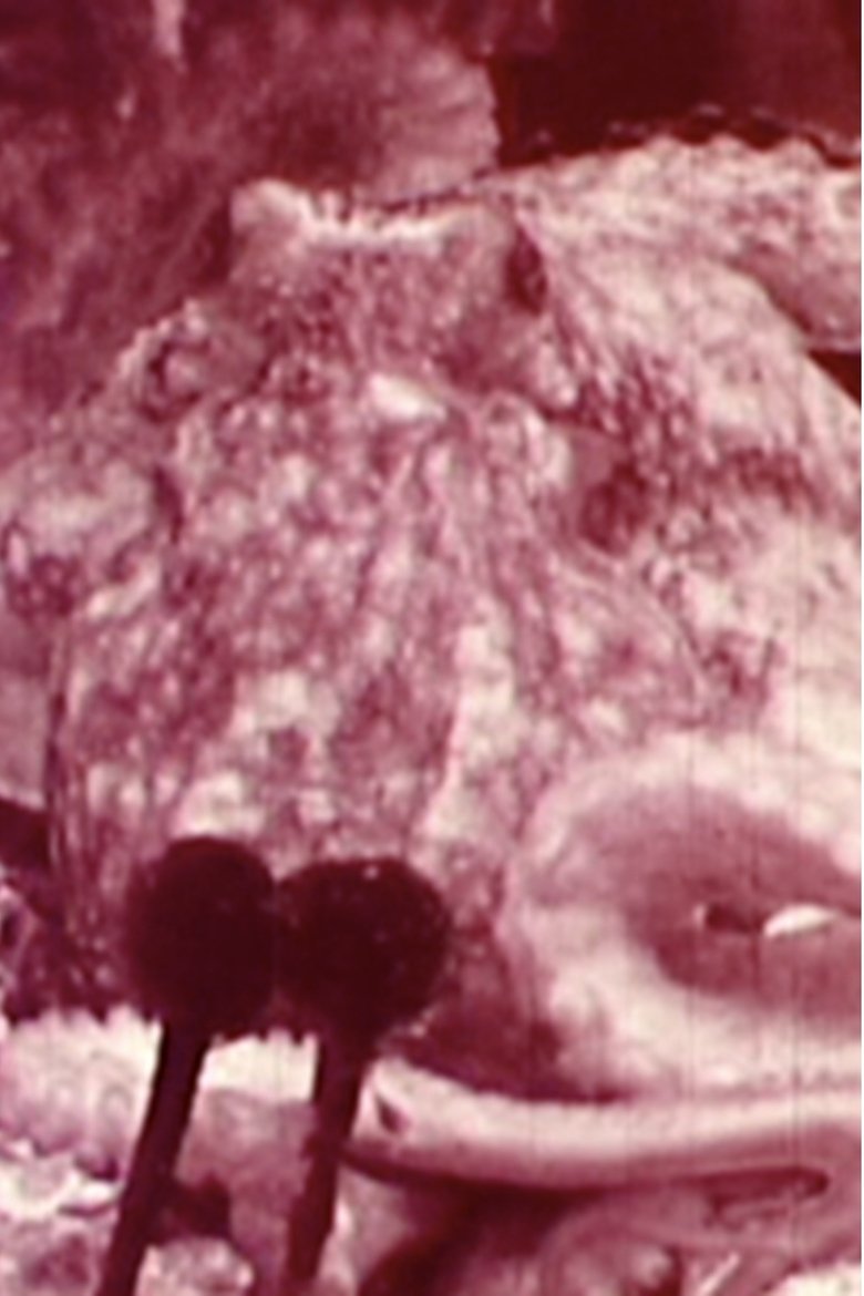 Poster of Aurora Borealis